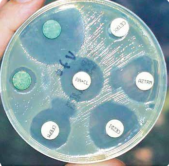Antibioticaresistentie - Verschillende groottes van remzones